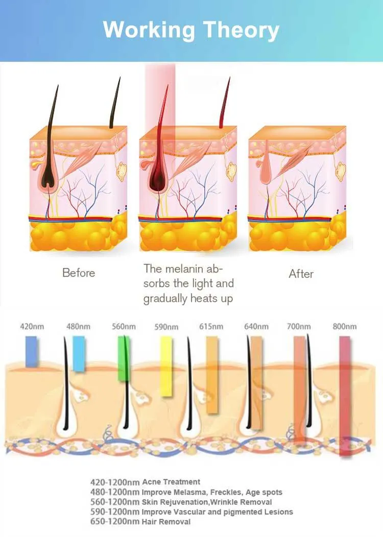 IPL+RF+Elight Intelligent Beauty Equipment Is Multi-Function Which Integrates